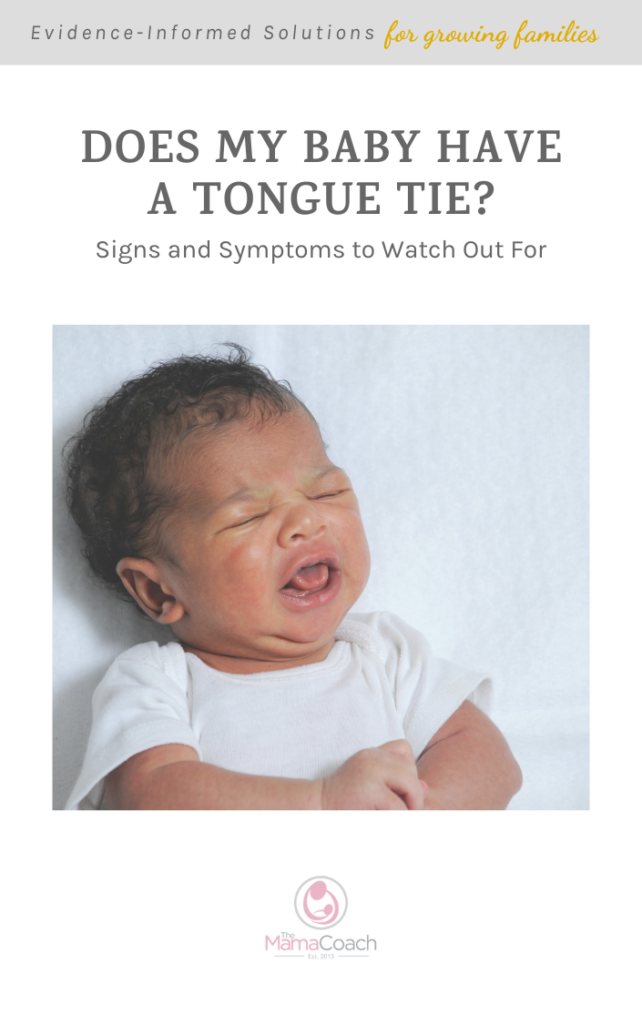 Free Baby Feeding Guide: Does my Baby Have a Tongue Tie?